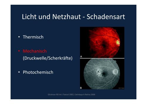 Verblitzt, verstrahlt – licht- und strahleninduzierte ...