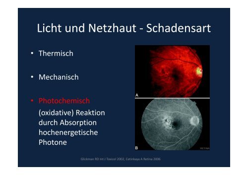 Verblitzt, verstrahlt – licht- und strahleninduzierte ...