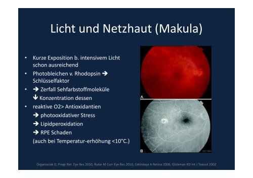 Verblitzt, verstrahlt – licht- und strahleninduzierte ...