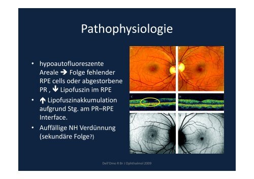 Verblitzt, verstrahlt – licht- und strahleninduzierte ...