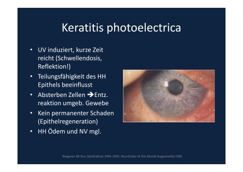 Verblitzt, verstrahlt – licht- und strahleninduzierte ...