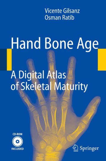 Hand Bone Age: A Digital Atlas of Skeletal Maturity - sepeap