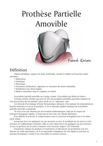 Prothèse Partielle Amovible - Laboratoire Adequat