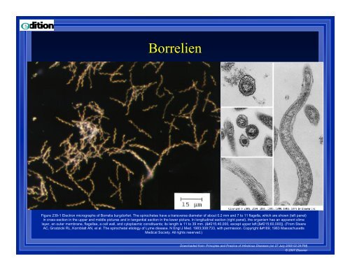 Borreliose im Kindes- u. Jugendalter