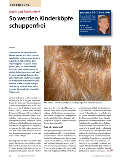 Gneis Und Milchschorf So Werden Kinderkopfe Dermabene