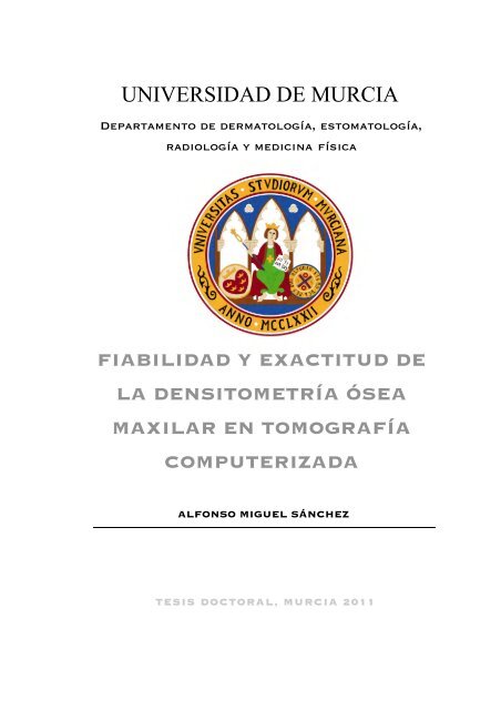diámetro del voladizo de la próstata 31 mm es igual