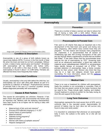 Anencephaly (PDF) - California Department of Public Health