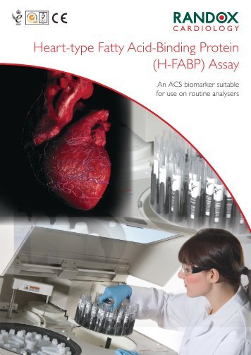 Heart-type Fatty Acid-Binding Protein (H-FABP) Assay