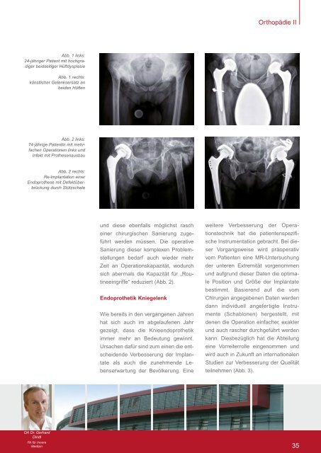 Publikations - Orthopädisches Spital Speising