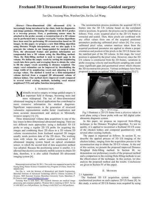 Freehand 3D Ultrasound Reconstruction for Image-Guided surgery