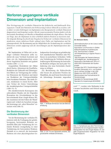 Verloren gegangene vertikale Dimension und Implantation