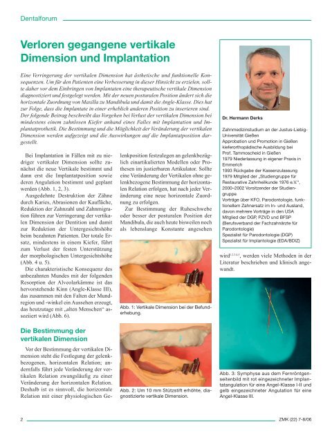 Verloren gegangene vertikale Dimension und Implantation