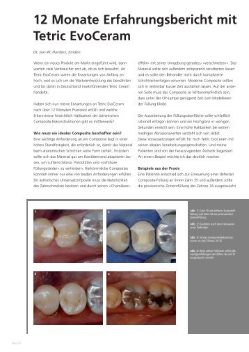 12 Monate Erfahrungsbericht mit Tetric EvoCeram - Dr. Jan-Willms ...