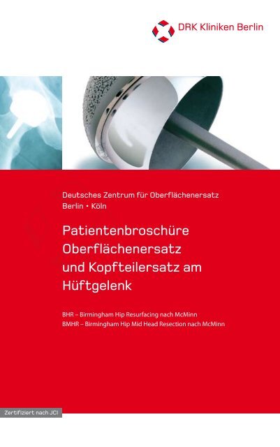 Oberflächenersatz am Hüftgelenk - DRK Kliniken Berlin