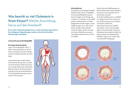 Cholesterin voll im Griff - Dr. med. Erik-C. Miller