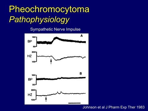 Pheochromocytoma - University of Colorado Denver