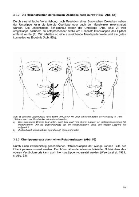 Grundlagen der Gesichtschirurgie