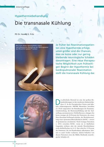 Die transnasale Kühlung - Benechill.com