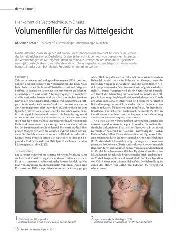 Volumenfiller für das Mittelgesicht - Dr. Zenker Dermatologie