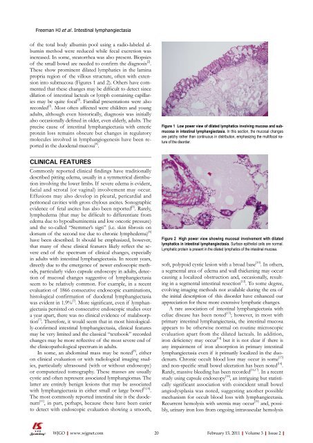 2 - World Journal of Gastroenterology