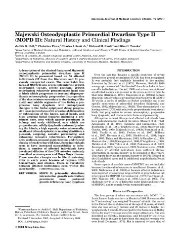 Majewski osteodysplastic primordial dwarfism type II (MOPD II ...