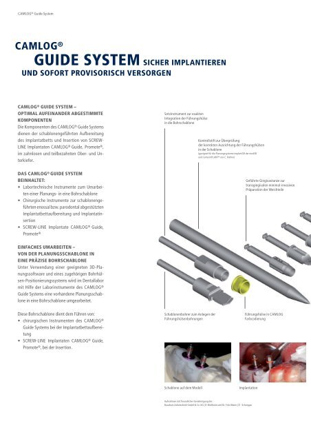 CAMLOG® Guide System - Alltec Dental