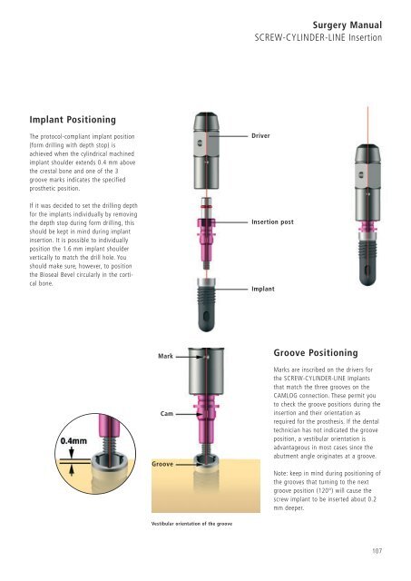 1 Surgery CAMLOG Compendium