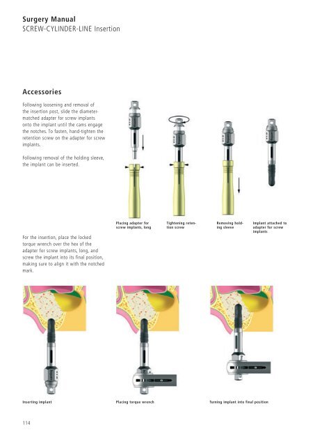 1 Surgery CAMLOG Compendium