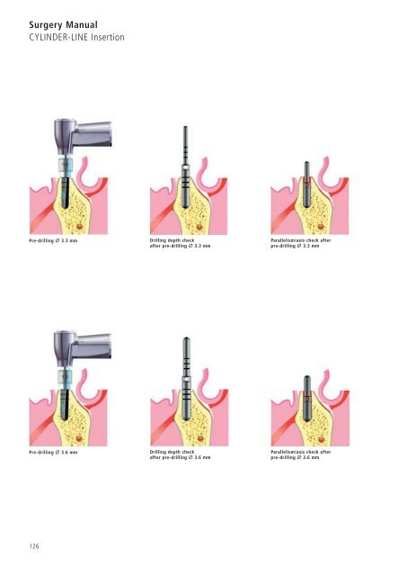 1 Surgery CAMLOG Compendium