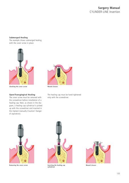 1 Surgery CAMLOG Compendium