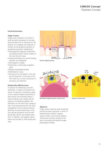 1 Surgery CAMLOG Compendium