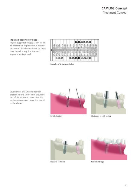 1 Surgery CAMLOG Compendium