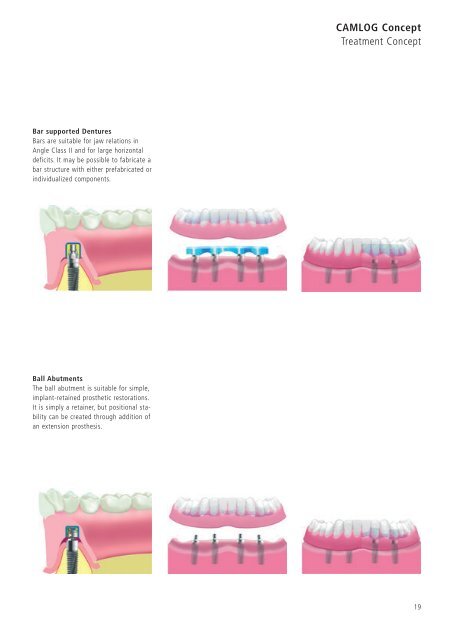 1 Surgery CAMLOG Compendium