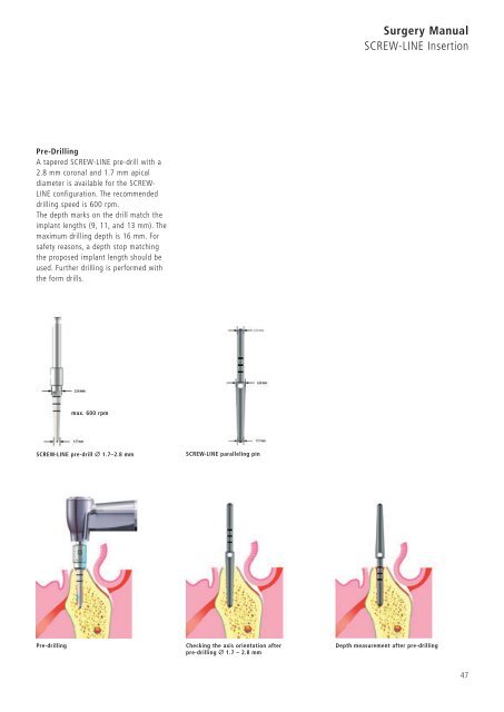 1 Surgery CAMLOG Compendium