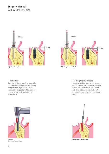 1 Surgery CAMLOG Compendium