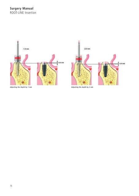 1 Surgery CAMLOG Compendium