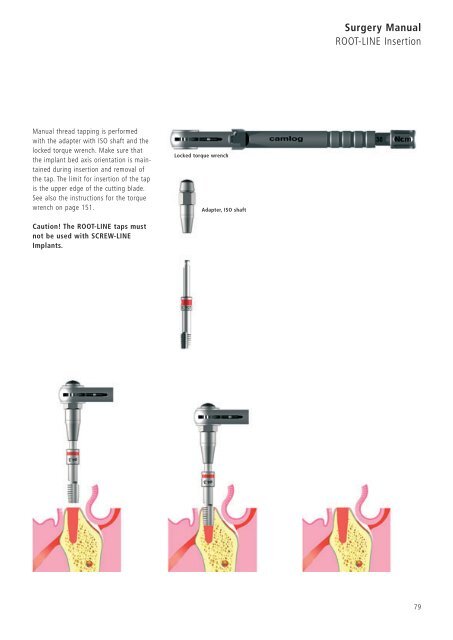 1 Surgery CAMLOG Compendium