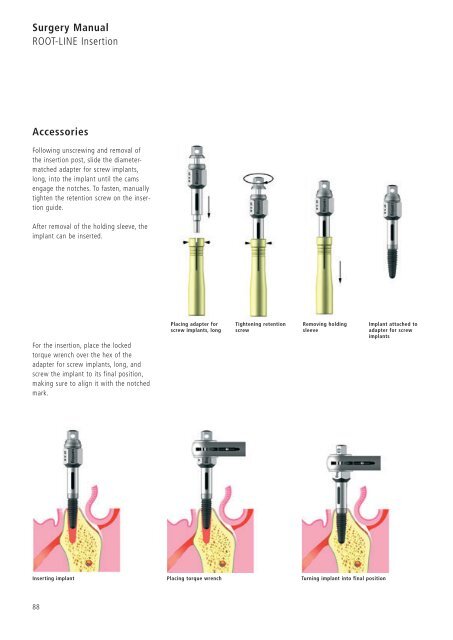 1 Surgery CAMLOG Compendium