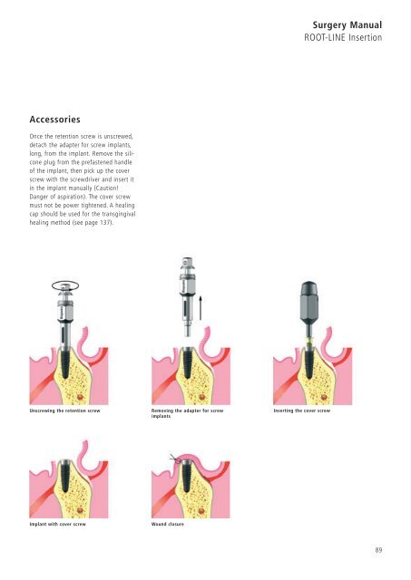 1 Surgery CAMLOG Compendium