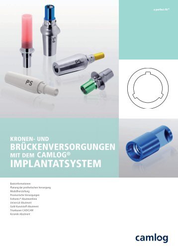 Kronen- und Brückenversorgungen - Camlog