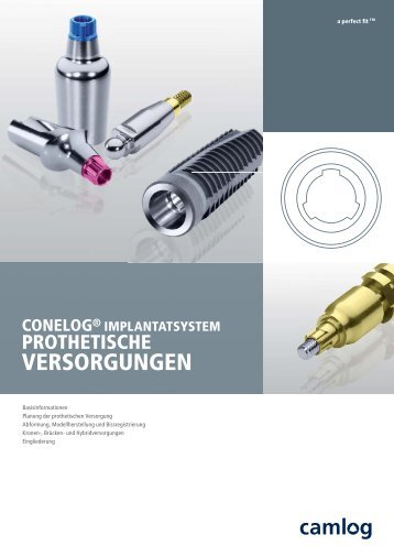 CONELOG® Implantatsystem Prothetische Versorgungen - Camlog