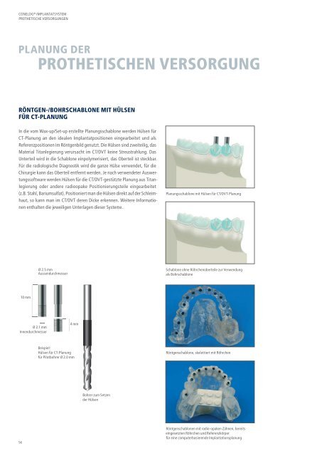 CONELOG® Implantatsystem Prothetische Versorgungen - Camlog