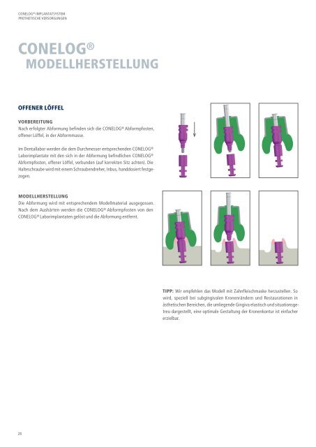 CONELOG® Implantatsystem Prothetische Versorgungen - Camlog