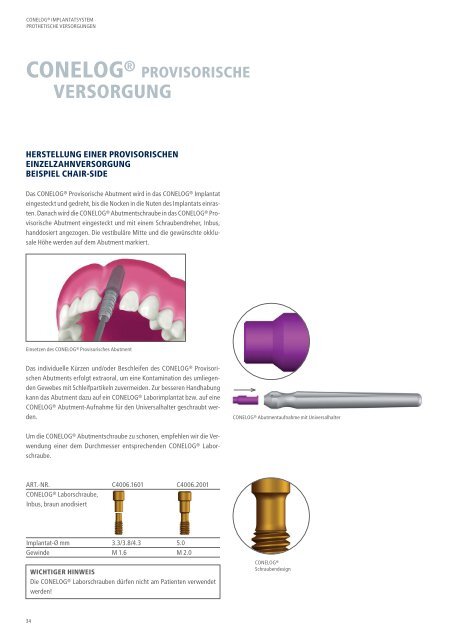 CONELOG® Implantatsystem Prothetische Versorgungen - Camlog