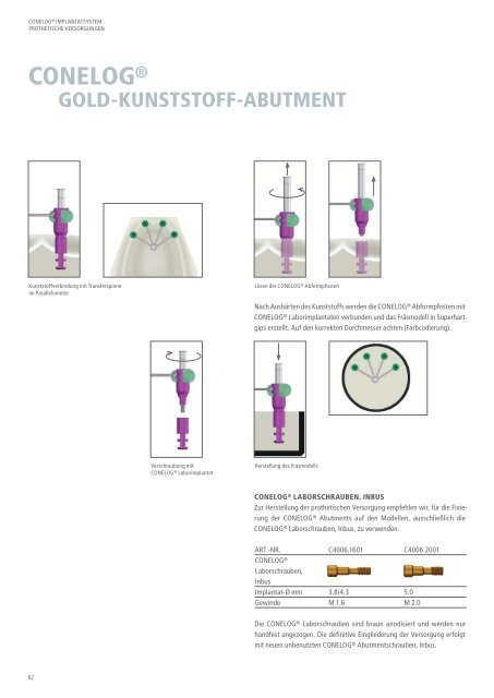 CONELOG® Implantatsystem Prothetische Versorgungen - Camlog