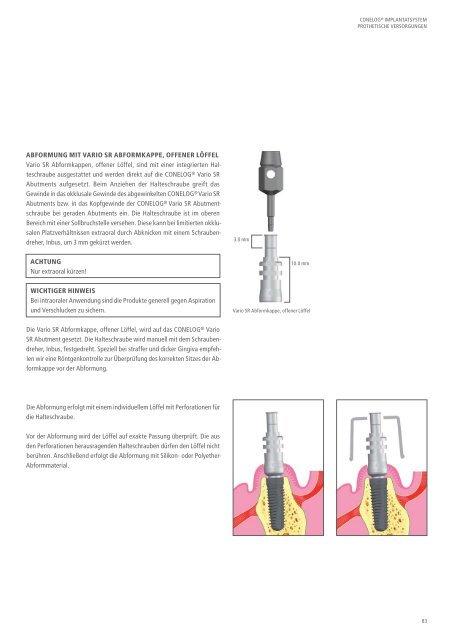 CONELOG® Implantatsystem Prothetische Versorgungen - Camlog