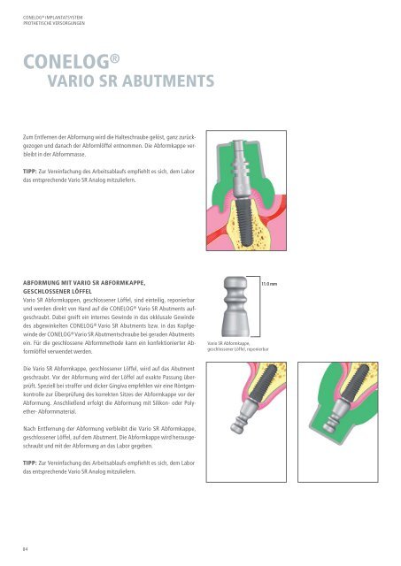 CONELOG® Implantatsystem Prothetische Versorgungen - Camlog