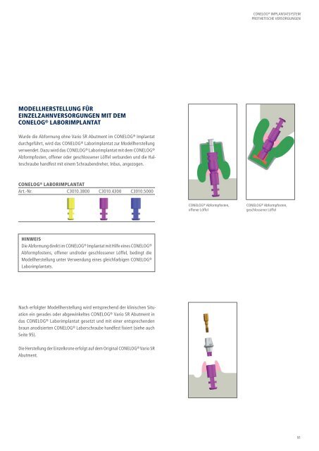 CONELOG® Implantatsystem Prothetische Versorgungen - Camlog