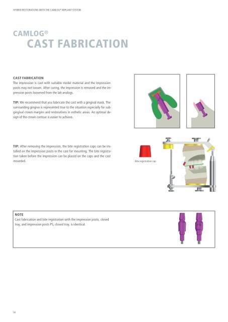 Hybrid Restorations with the CAMLOG Implant System (PDF