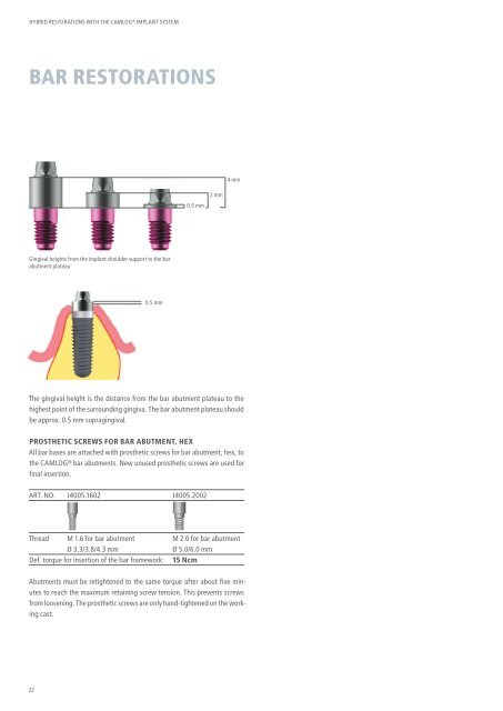 Hybrid Restorations with the CAMLOG Implant System (PDF